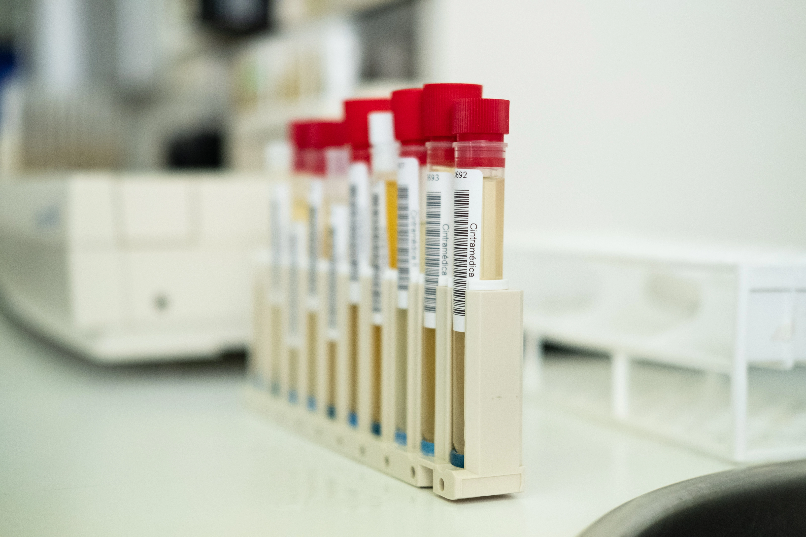 tubo de ensaios para análises clíncas no laboratório cerftificado e recomendado da Cintramédica 
