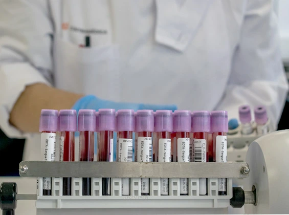 Tubos de colheitas Laboratório de Análises Clínicas na Cintramédica