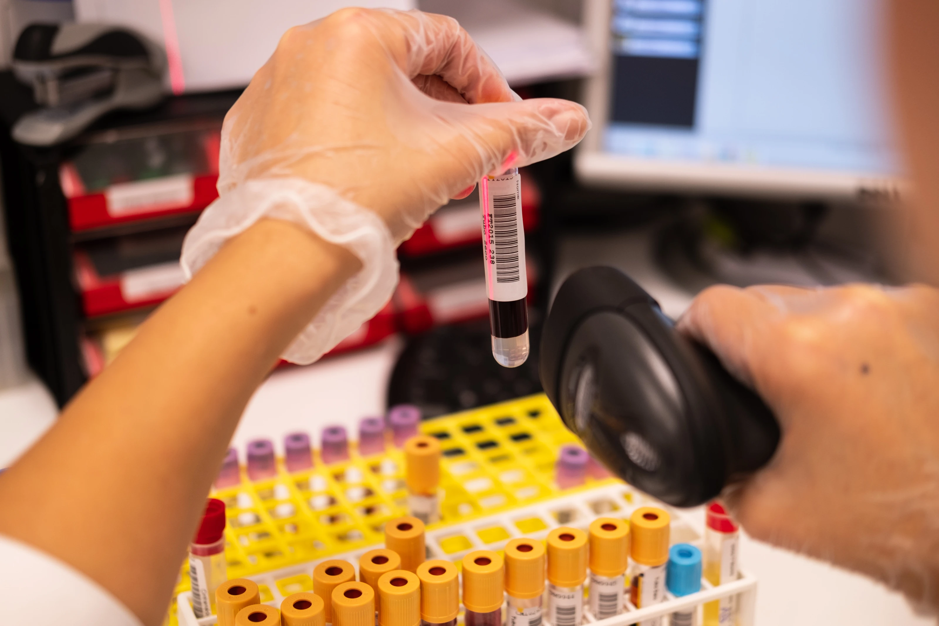 Técnica de laboratório a preparar exame de sangue para diagnósticodas análises clínicas 