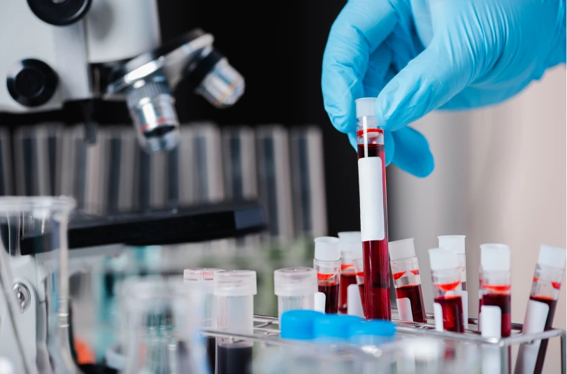 Técnica de laboratório a preparar exame de sangue para diagnósticodas análises clínicas 