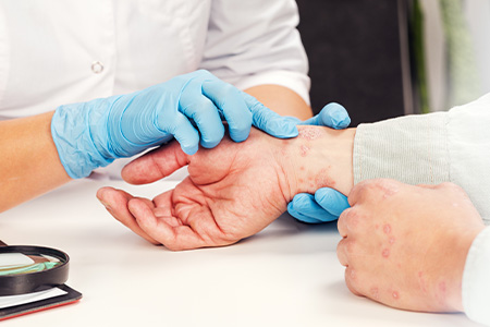 Consulta de Alergologia Cutânea