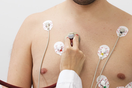 Ecocardiograma de Sobrecarga Física sem Fármacos