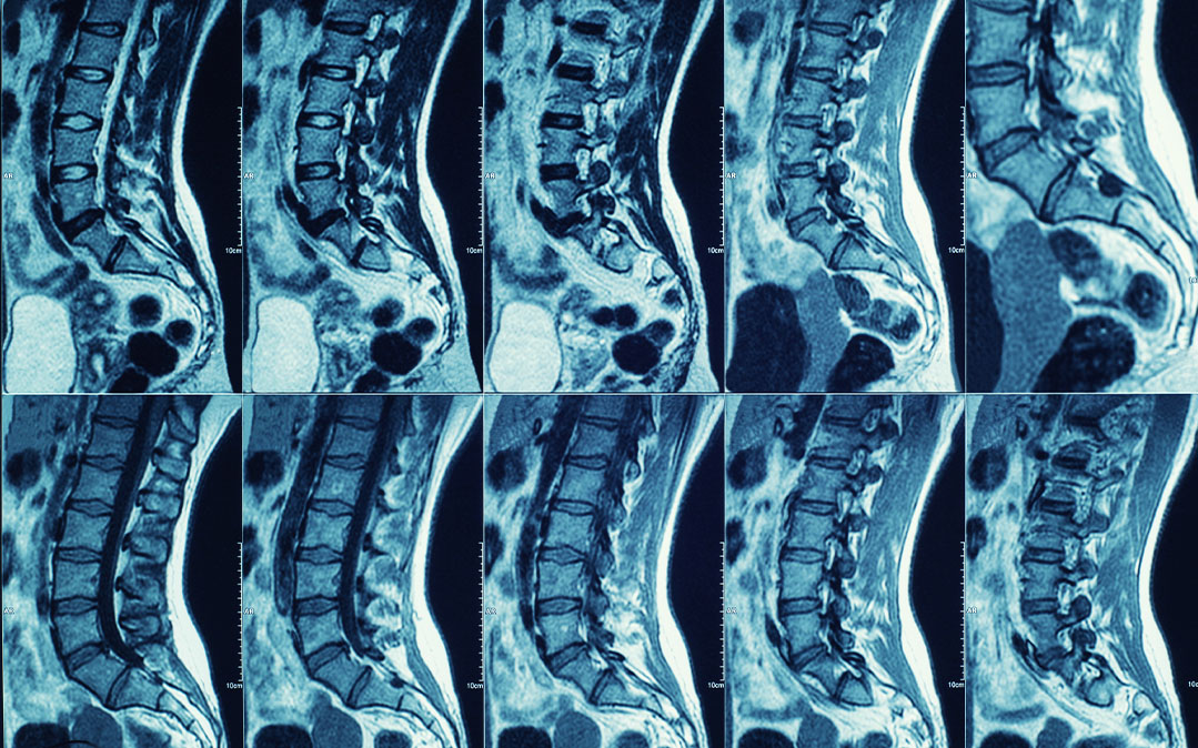 Tudo o que sempre quis saber sobre Ressonância Magnética
