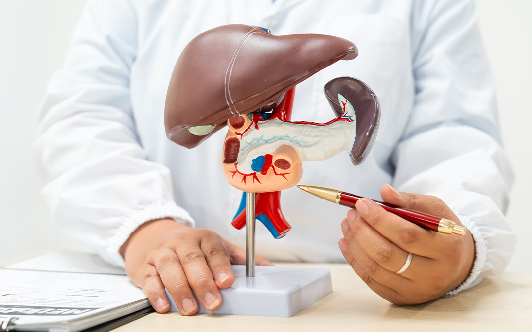 Hepatite A: o que é, quais os sintomas e como se transmite