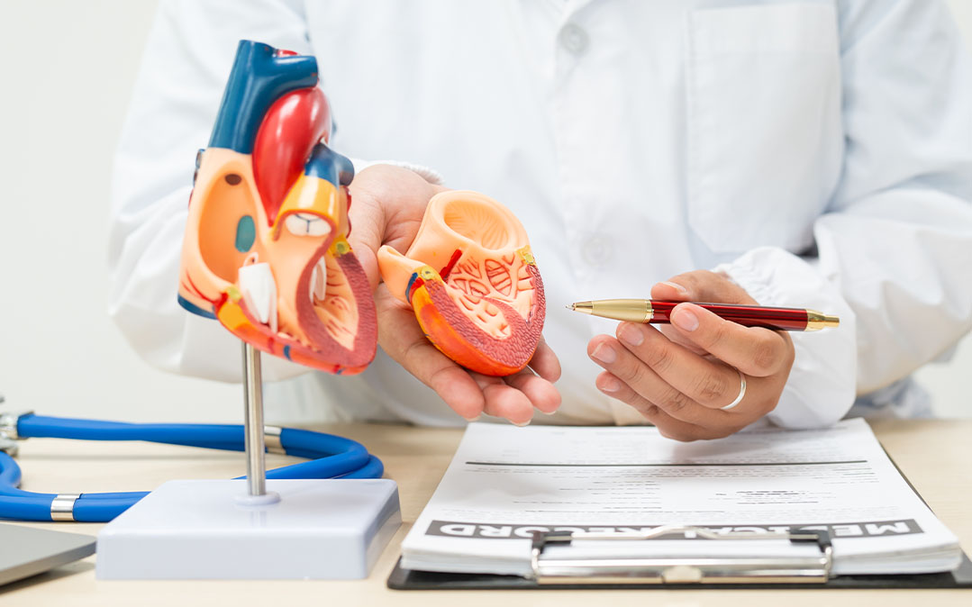 médico explica o que é Doença Coronária, usando um modelo 3D de um coração
